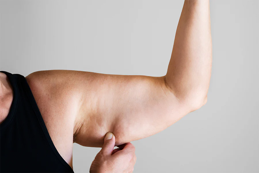 Flabby Arms: Top Causes and Tips to Get Rid of Them